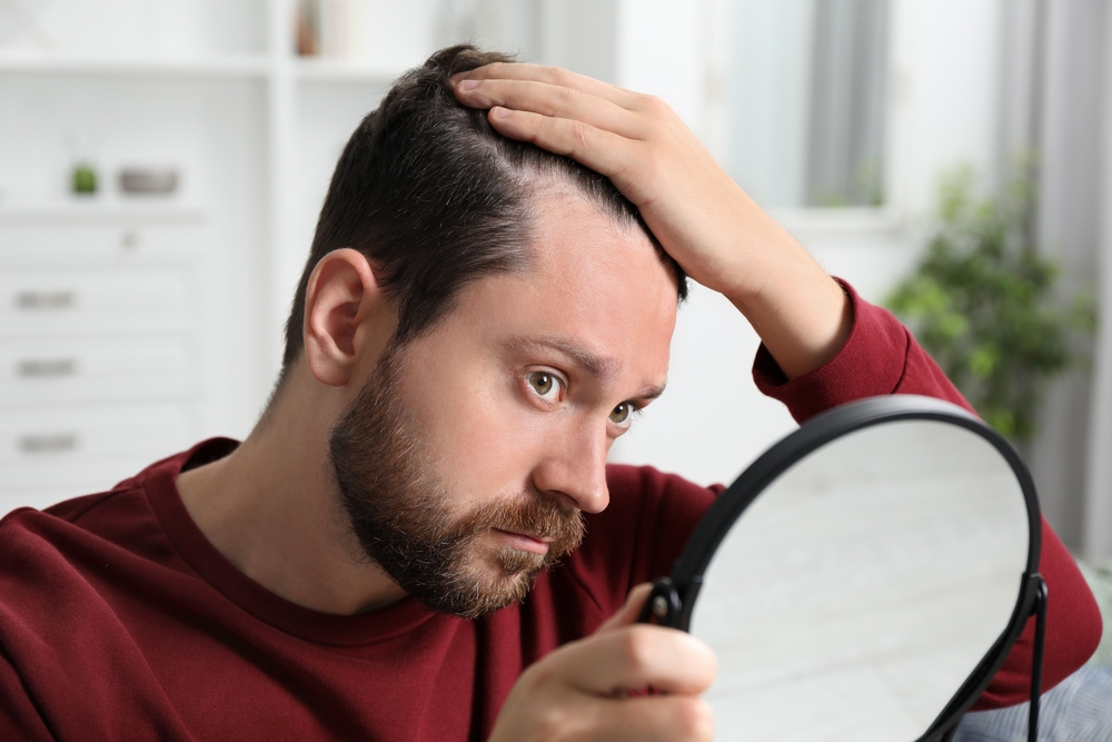 Hair Loss
